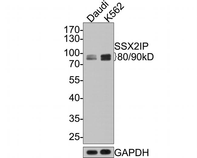 SSX2IP Antibody in Western Blot (WB)