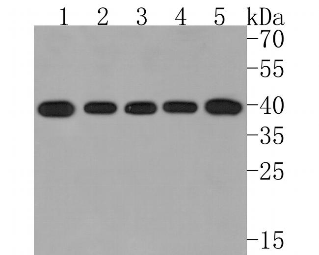 GNA13 Antibody in Western Blot (WB)