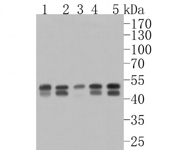 PTPN2 Antibody in Western Blot (WB)