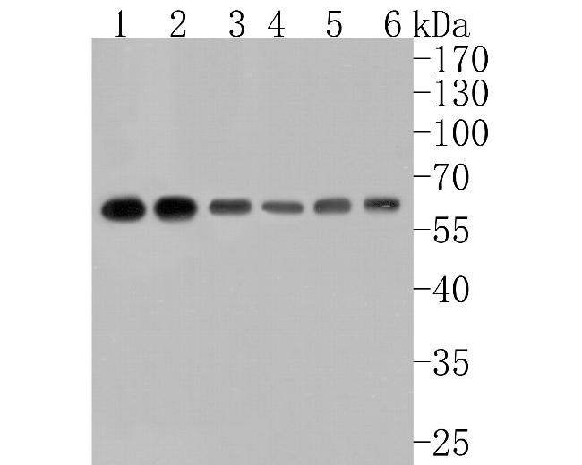 ELP3 Antibody in Western Blot (WB)