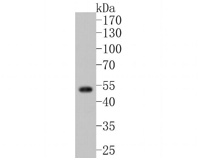 FKTN Antibody in Western Blot (WB)