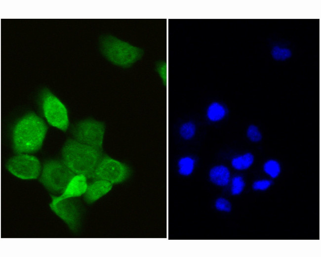 RCL Antibody in Immunocytochemistry (ICC/IF)