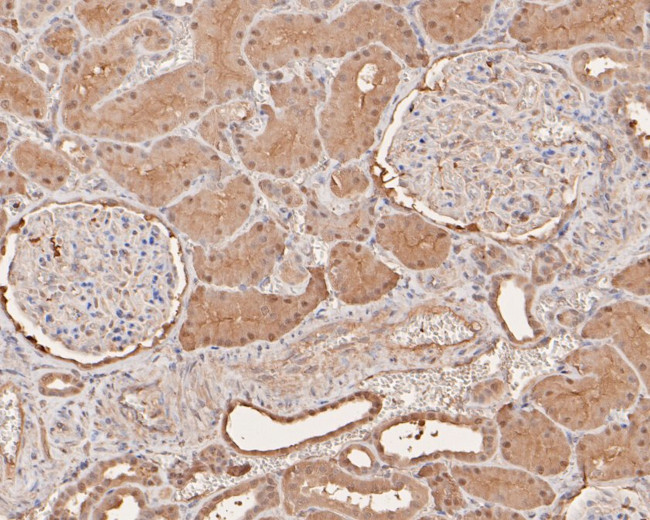 RCL Antibody in Immunohistochemistry (Paraffin) (IHC (P))