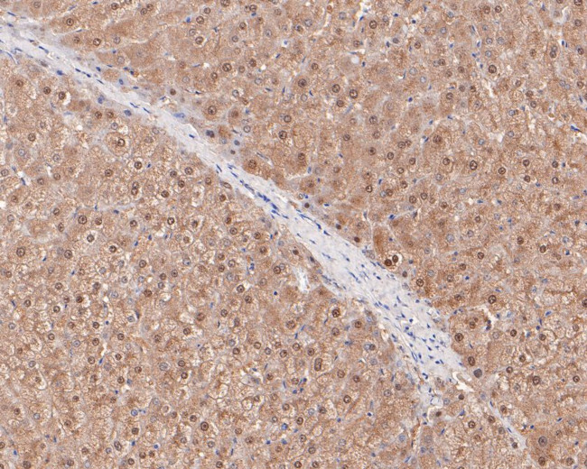 RCL Antibody in Immunohistochemistry (Paraffin) (IHC (P))