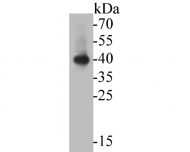 ABH1 Antibody in Western Blot (WB)