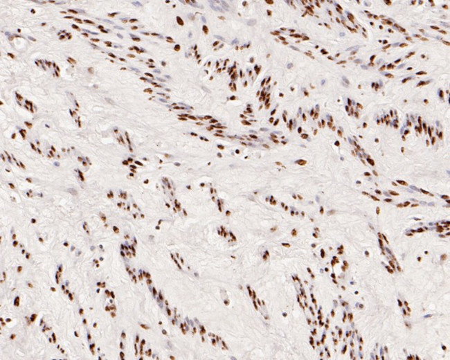 SNRPA1 Antibody in Immunohistochemistry (Paraffin) (IHC (P))