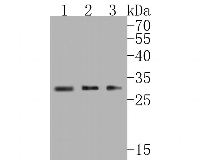 SNRPA1 Antibody in Western Blot (WB)