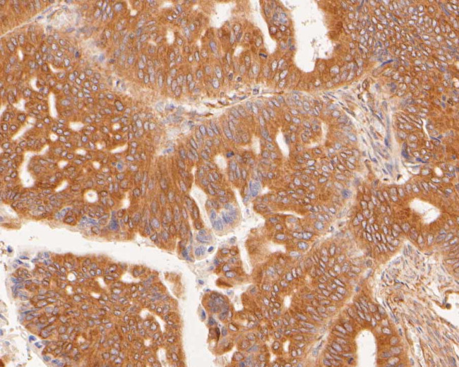 SLC27A4 Antibody in Immunohistochemistry (Paraffin) (IHC (P))