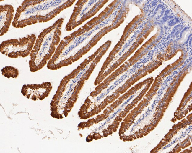 SLC27A4 Antibody in Immunohistochemistry (Paraffin) (IHC (P))