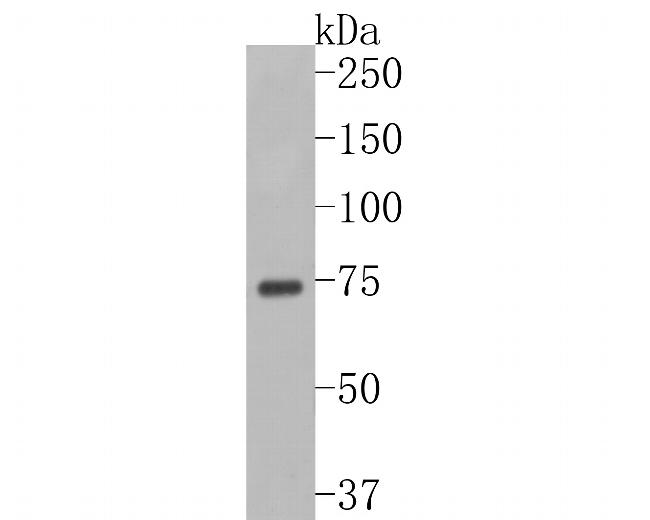 SLC27A4 Antibody in Western Blot (WB)