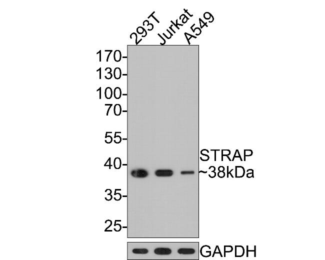 STRAP Antibody in Western Blot (WB)