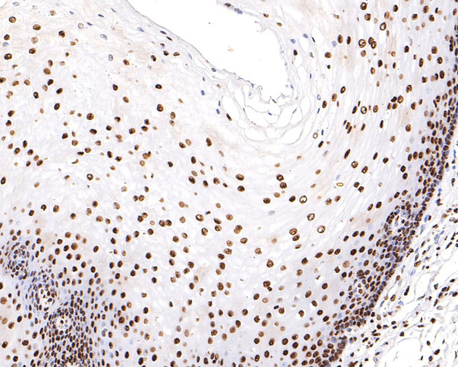 H3K18ac Antibody in Immunohistochemistry (Paraffin) (IHC (P))