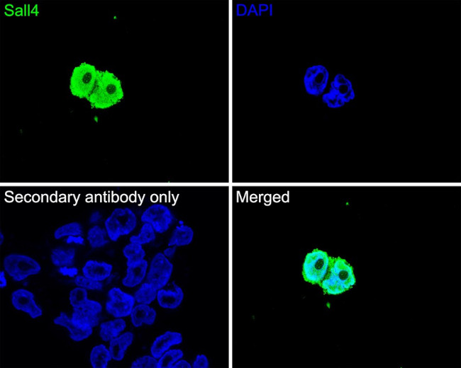 SALL4 Antibody in Immunocytochemistry (ICC/IF)