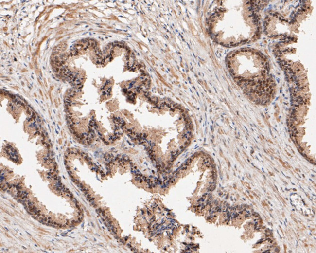 FOXA1 Antibody in Immunohistochemistry (Paraffin) (IHC (P))