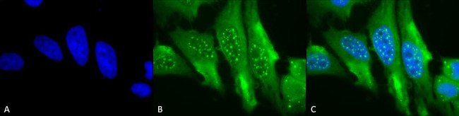 HO-1 Antibody in Immunocytochemistry (ICC/IF)