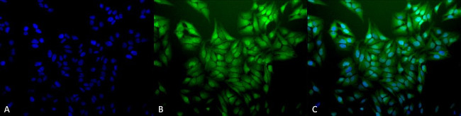 Ubiquitin Antibody in Immunocytochemistry (ICC/IF)