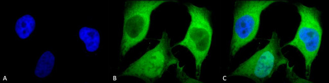 Ubiquitin Antibody in Immunocytochemistry (ICC/IF)