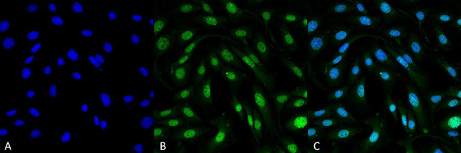 MDC1 Antibody in Immunocytochemistry (ICC/IF)