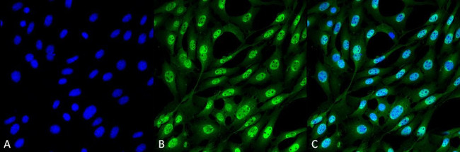 Ubiquitin Antibody in Immunocytochemistry (ICC/IF)