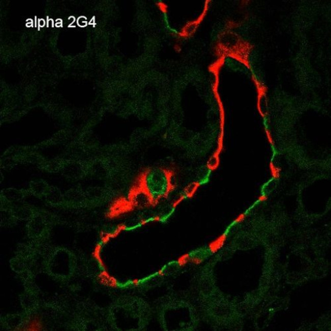 alpha-ENaC Antibody in Immunohistochemistry (Paraffin) (IHC (P))