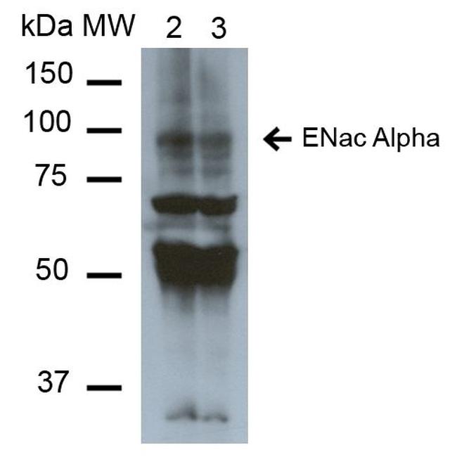 alpha-ENaC Antibody in Western Blot (WB)