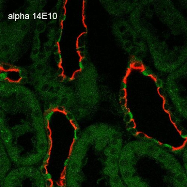alpha-ENaC Antibody in Immunohistochemistry (Paraffin) (IHC (P))