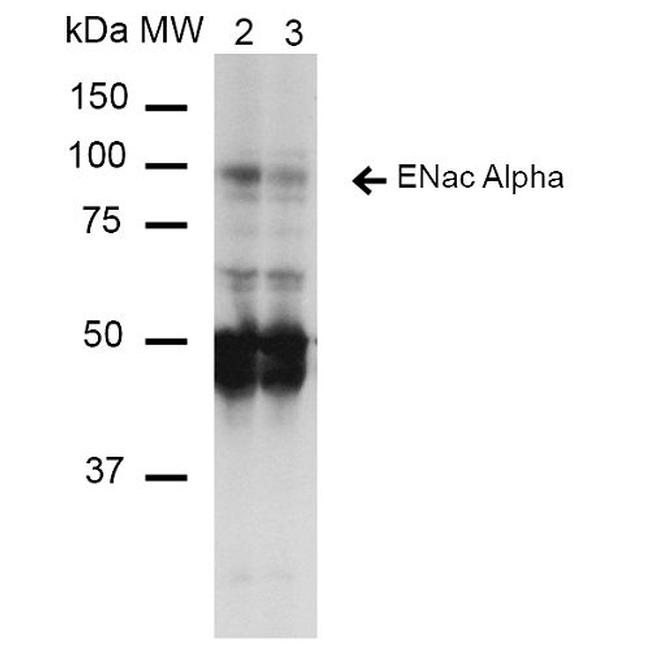 alpha-ENaC Antibody in Western Blot (WB)