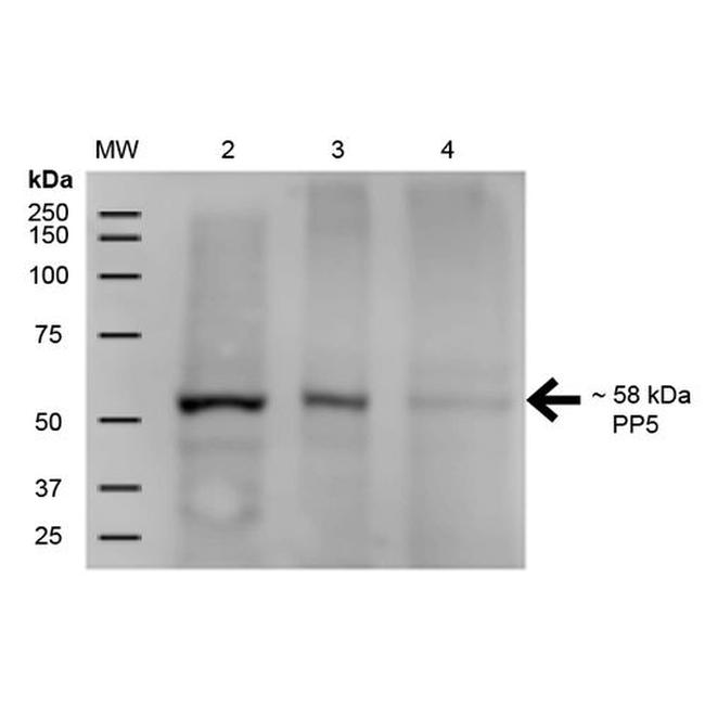 PP5 Antibody in Western Blot (WB)