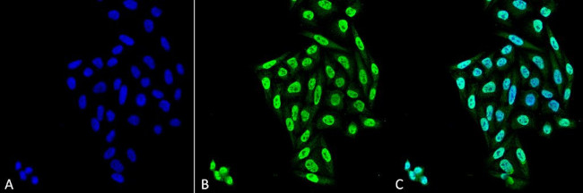 PP5 Antibody in Immunocytochemistry (ICC/IF)