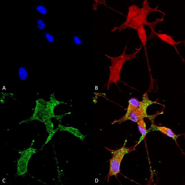 CaV3.2 Antibody in Immunocytochemistry (ICC/IF)