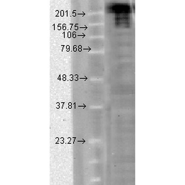 SCN9A Antibody in Western Blot (WB)