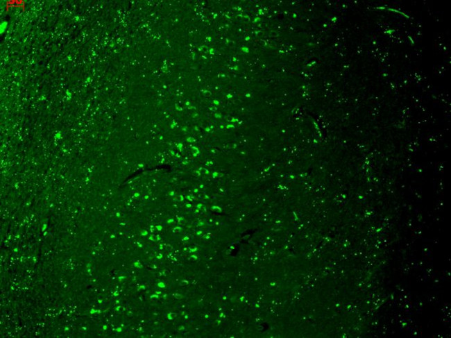 TRPV3 Antibody in Immunohistochemistry (Paraffin) (IHC (P))