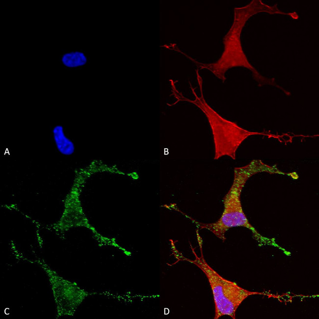 CACNB2 Antibody in Immunocytochemistry (ICC/IF)