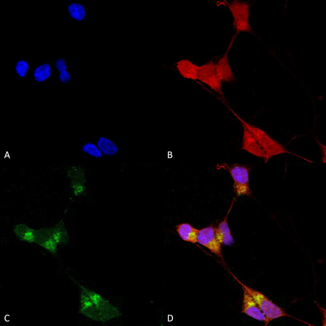 GABRD Antibody in Immunocytochemistry (ICC/IF)