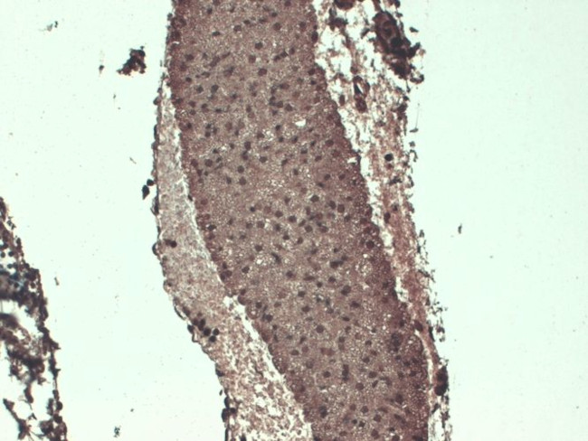 SLC5A5 Antibody in Immunohistochemistry (PFA fixed) (IHC (PFA))