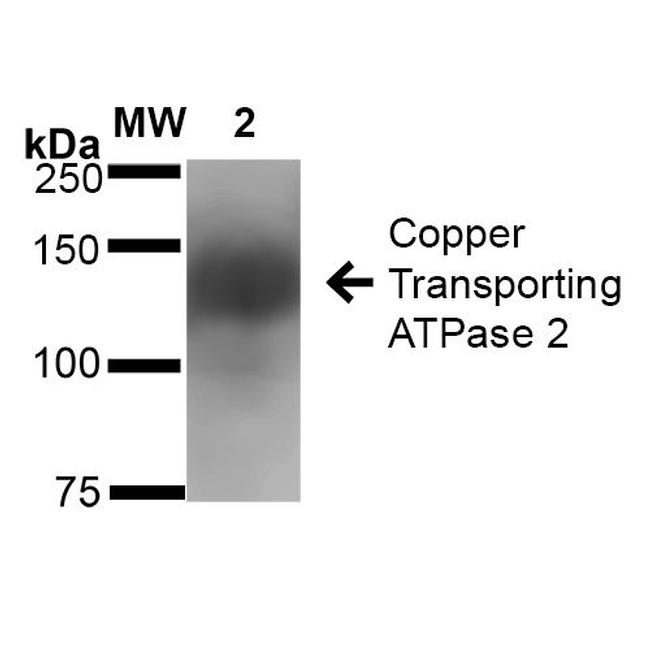 ATP7B Antibody in Western Blot (WB)