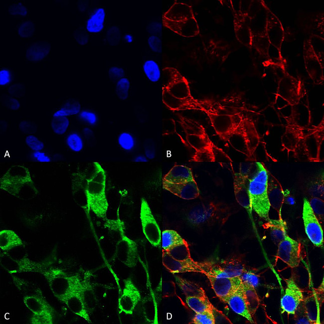 Versican Antibody in Immunocytochemistry (ICC/IF)