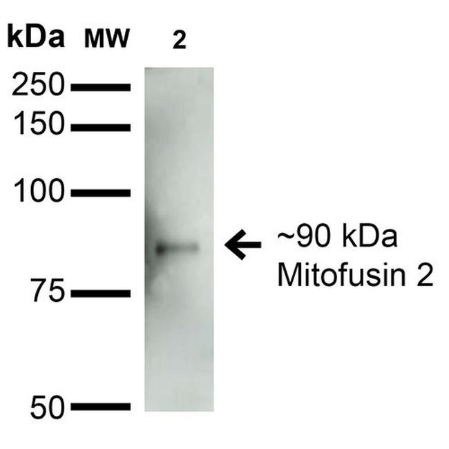 MFN2 Antibody in Western Blot (WB)