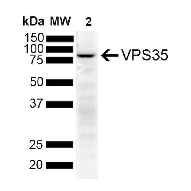 VPS35 Antibody in Western Blot (WB)
