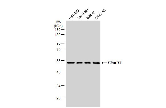 C9orf72 Antibody in Western Blot (WB)