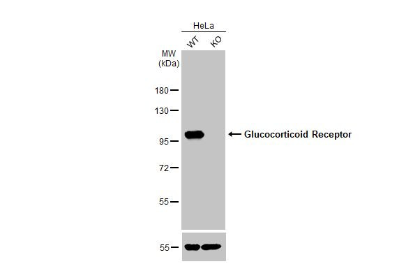 Glucocorticoid receptor (NR3C1) Antibody in Western Blot (WB)