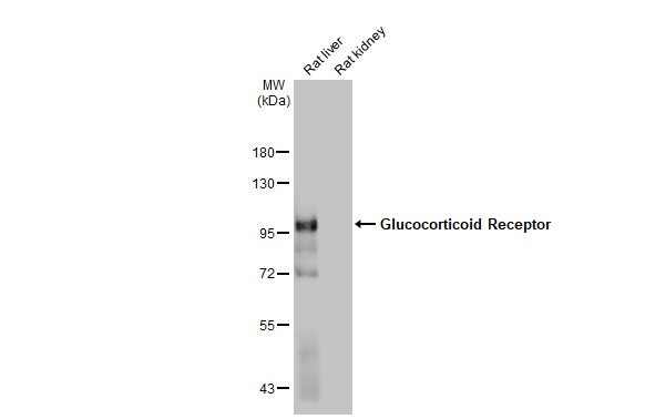 Glucocorticoid receptor (NR3C1) Antibody in Western Blot (WB)