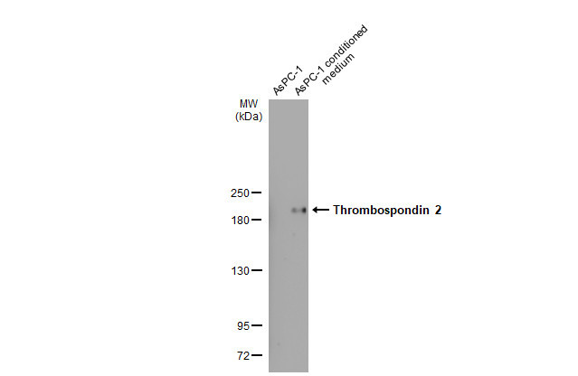 Thrombospondin 2 Antibody in Western Blot (WB)