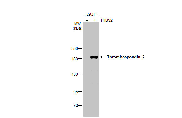 Thrombospondin 2 Antibody in Western Blot (WB)