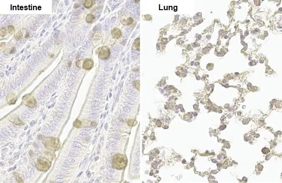 NUP62 Antibody in Immunohistochemistry (Paraffin) (IHC (P))