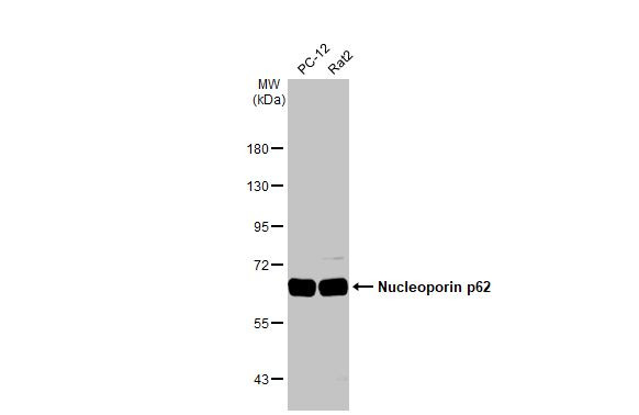 NUP62 Antibody in Western Blot (WB)