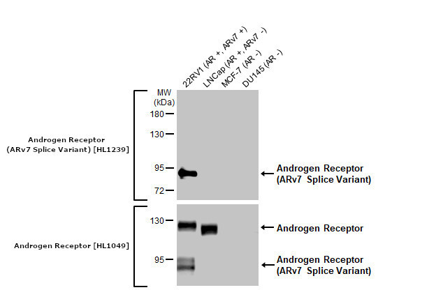 Androgen Receptor (ARv7 Splice Variant) Antibody in Western Blot (WB)
