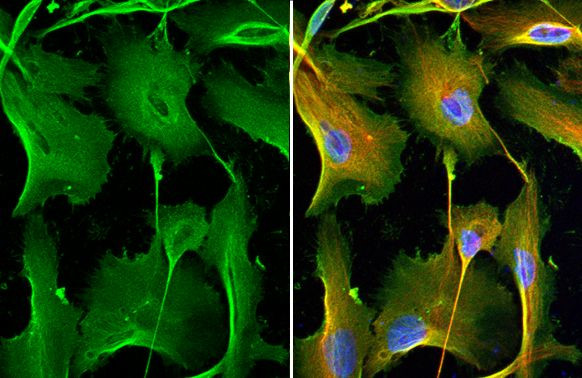 MMP1 Antibody in Immunocytochemistry (ICC/IF)