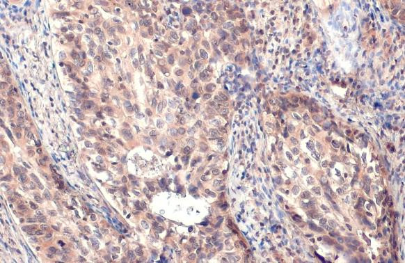 MMP1 Antibody in Immunohistochemistry (Paraffin) (IHC (P))