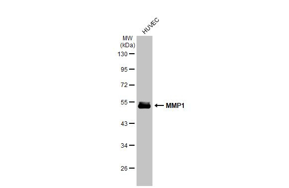 MMP1 Antibody in Western Blot (WB)